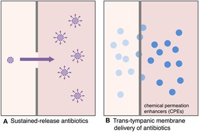 Novel Antimicrobial Treatment Strategy Based on Drug Delivery Systems for Acute Otitis Media